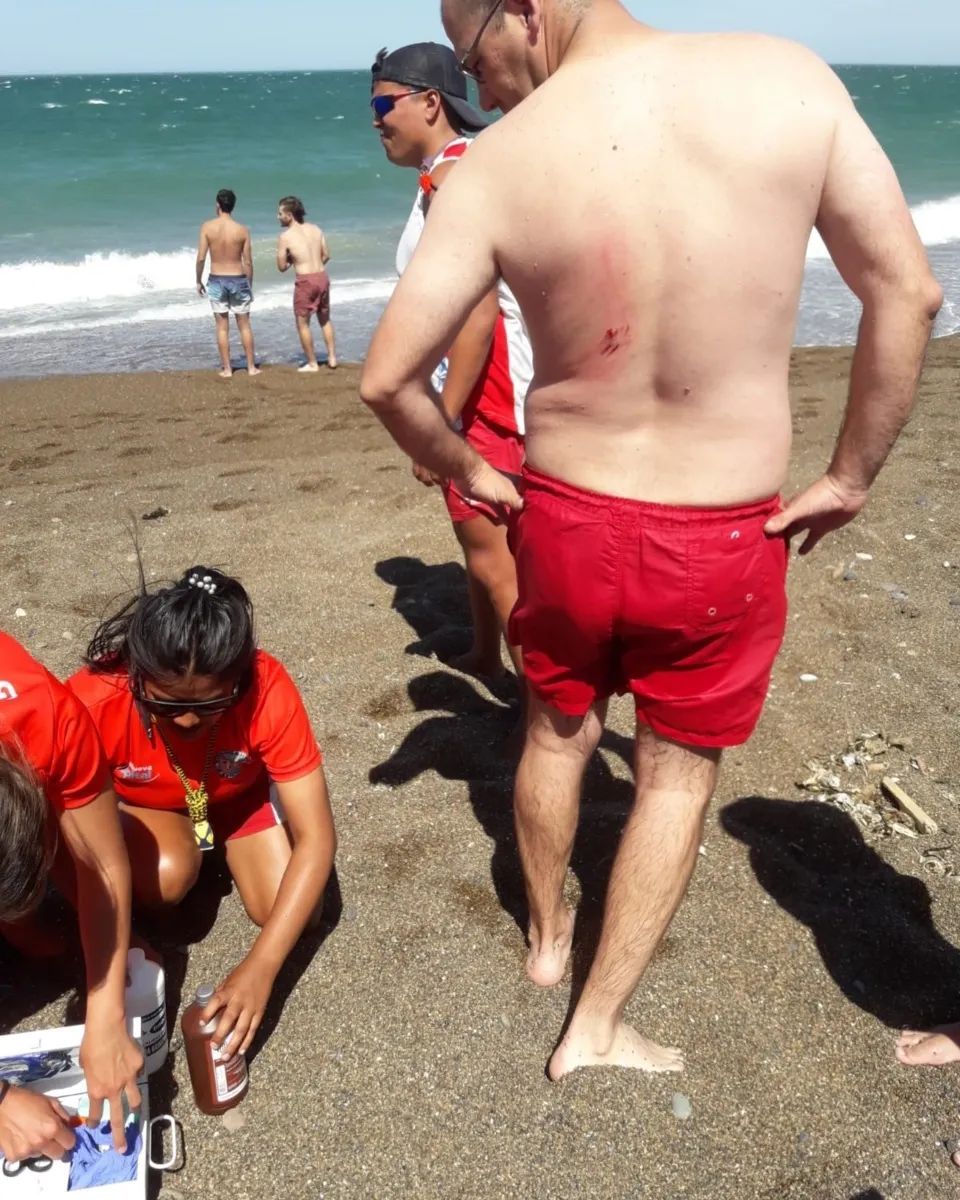 Ataque de lobo marino en Playa Unión