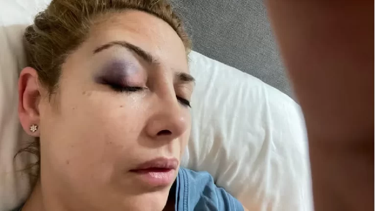 Nuevas fotos revelan golpes en el rostro de Fabiola Yañez