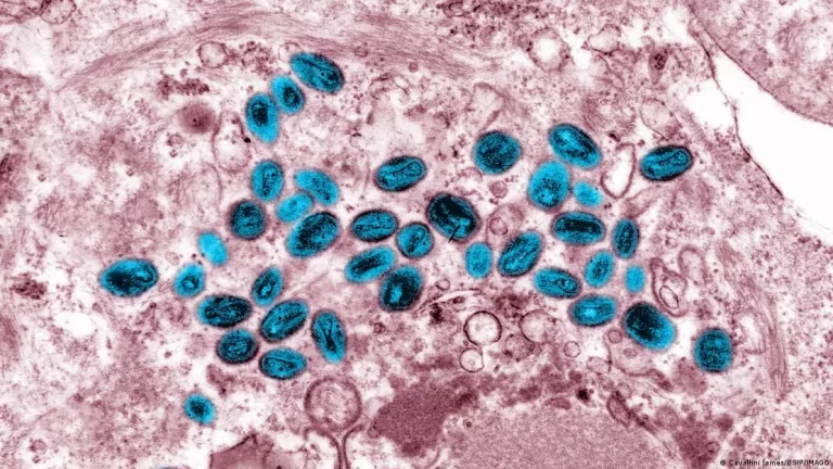 El ADN de momias chilenas confirma que la viruela llegó a América desde Europa